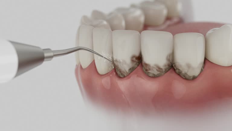 Trusted Wisdom Tooth Removal service in Lake Holiday, IL - Dentist Open Now